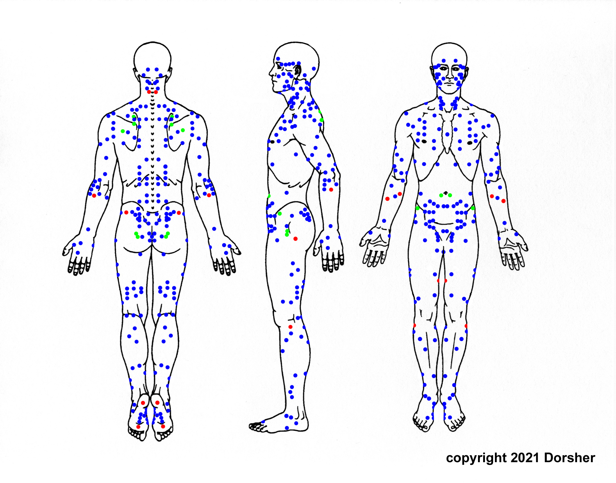 Trigger Point Three Trigger Point Manual